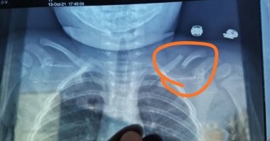 Да да, вообще не увидеть......