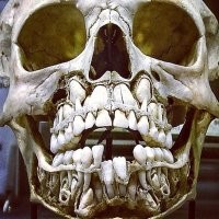 в смысле не выросли? Вот у детей они уже готовы, когда еще молочные на месте. Речь, все таки, о том, что нет в принципе даже точке роста этих зубов.