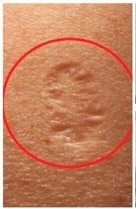 Вот вам свидетельство, что и тогда чипировали. Чип был тёплый, ламповый и работал  в СВ - диапазоне.