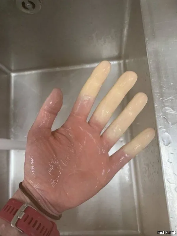 У него стресс