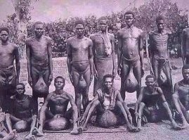 Классно! Прямо всё в кучу,особенно фоточки! Все вакцины одинаково полезны,особенно экспериментальные! Теперь мы знаем кто виноват - сомневающиеся! Именно из-за них страдает весь мир,ущемлённый в правах! Именно из-за них погибла экономика,из-за них мы не ходим в театры и музеи! И плевать,что вакцинированные так же бессимптомно болеют,и являются разносчиками! Теперь когда виноватые назначены,пора вспомнить,что тяжелые времена требуют тяжелых мер! Чтобы люди боялись наказания больше чем негативных последствий вакцинации(коих по официальной статистике и так нет совсем) Помнится в Риме легионы запятнавшие себя трусостью подвергали децимации,когда каждый десятый забивался до смерти. Настала пора побороться за коллективный иммунитет! И массовые публичные наказания,будут как никогда своевременны! Почему бы не начать,наказывать за отказ вакцинации их друзей(что не написали на них куда следует),а так же родственников и детей! Может тогда до них дойдёт! В конце концов и немцы сжигали деревни вместе с населением,но мы то понимаем что виноваты не фашисты а кровавый усач,и это было вынужденной мерой! Пока не поздно надо одуматься,и победить ковид! Ведь неизвестно,что он нам готовит,возможно скоро у всех от нового штамма начнут пухнуть гениталии,и что тогда?!