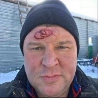 Это была плохая идея, поэтому её все ринулись исполнять