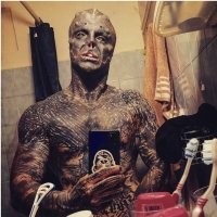 Блогер Энтони Лоффредо всегда испытывал страсть к инопланетянам. Только за прошлый год он успел разрезать себе язык, отрезать нос, уши и все тело покрыть татуировками. Не обошел стороной и глазные белки. А чтобы точно походить на пришельца – отрезал себе верхнюю губу.(с)
Вот инопланетяне ох#еют когда его увидят...