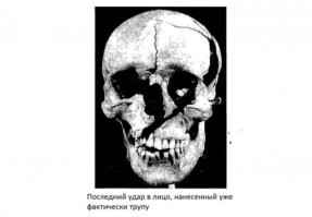 "Следующая часть тела, которая в наибольшей степени пострадала – это собственно голова, причем как можно видеть наибольшее количество ударов приходится справой стороны. Как отмечает Бойлстон это обусловлено тем, что большинство воинов были правшами, соответственно удар наносился справа налево."

Автор, ты запутался с правыми и левыми руками. Правша бьёт справа, соответственно у противника страдает левая сторона тела - левая сторона головы и левая нога. Посмотри на фотки, что ты привёл. Раны на черепе с левой стороны.