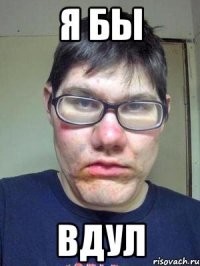 История Мэри Энн Вебстер - самой уродливой женщины в мире