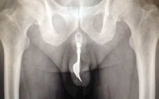 Кто этот интелегент у кого вместо х@я вилка?