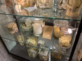 Бывал в таких музеях , у нас есть такой в Мехелене а в Тарту в Эстонии есть что то подобное , в нашем хоть и запомнил что то , но в Тарту мне только анатомия запомнилась и патология  . Не знаю если фотку поставлю забанят или нет . Если честно жену почти стошнило от увиденного а я ходил рассматривал , больше интерес был к печени и мозгам .