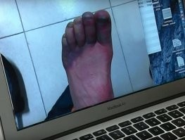 Обморожение не для ролевых игр