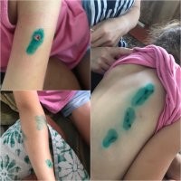 Родителям нужно научить пацана, что это чревато.
Не считая лишая, блох и прочей заразы: