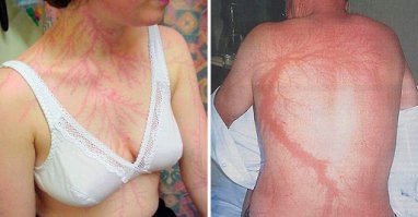 Зевсу дядя дорогу перешёл. Как пить дать! Вокруг столько высоких металлических предметов, а молния по нему шарахнула.
Со вторым днём рождения, короче!