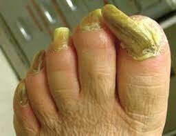 приступай)))