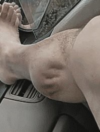 Так выглядит боль!