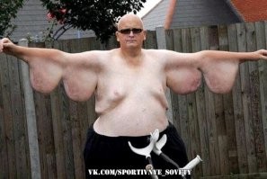 А лишнюю кожу с него тоже срезали и это тоже пошло в зачёт похудения