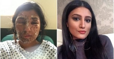 Я ОЧЕНЬ, ОЧЕНЬ, ОЧЕНЬ не добрый человек...
Эти шмары дальше жить будут и радоваться жизни...
А парень скорее всего инвалид...
Кислотой в рожу и пусть потом с ЭТИМ живут, радуются что на нож не посадили...
А тому кто этим шмарам так сделает, максимум 6 лет... по УДО через 3 года выйти можно...
А ШМАРЫ дальше пусть живут с таким личиком...
Разъяснительные бесебы, что типа это не хорошо тут не помогут...