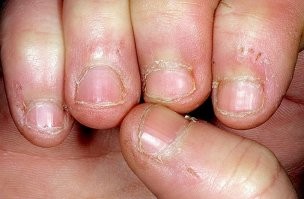 Прототипы Логана: 25 когтей из мира животных, которые вас удивят