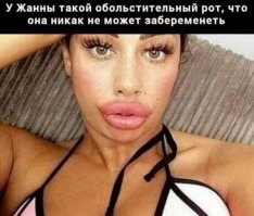 Пельмени вместо губ снова в моде?