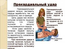 Прекардиальный удар это называется. В случае остановки сердца из за удара током показано 100%, в случае фибриляции - когда как...