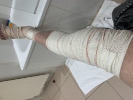 Иногда ты сам не понимаешь как ты все не переломал :) 28 февраля эффектное сальто на сноуборде :) хоть мозгов хватило страховку оплатить 5 евро в день .