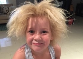 Это болезнь.
Синдром нерасчёсываемых волос (англ. Uncombable hair syndrome), также стекловидные волосы   редкая структурная аномалия волос, выражающаяся в изменении формы сечения волоса на голове и вызывающая, как следствие, невозможность расчесать и уложить торчащие волосы. Человек с таким синдромом имеет нормальное количество волос. Они обычно сухие и блестящие, но не ломкие; серебристо-русого или соломенного цвета.