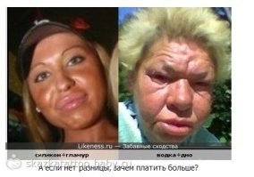 Скуластая красотка продолжает эксперименты с пластикой