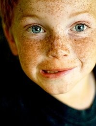 Это скорее пощечина от солнца, вот поцелуи: