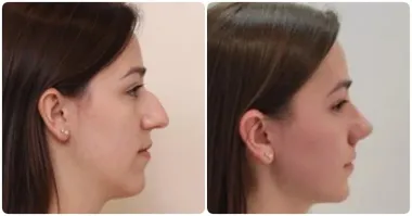 П.и.з.д.ё.ж. на этом фото две разные девушки. Ушные раковины у людей индивидуальные.