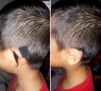 Люди, которые наконец решились на пластическую операцию - и ни на секунду не пожалели