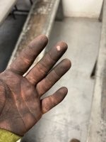 В рубцовой ткани отсутствуют потовые железы.
