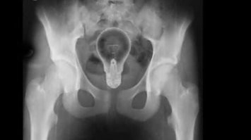 Тут, ничего странного! Проста возникла идея! Патом конечно станет понятно, что это лютый писец! Но на данный момент, она слишком заманчива!