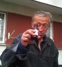 "Моргни, если сможешь": у Джастина Бибера парализовало половину лица