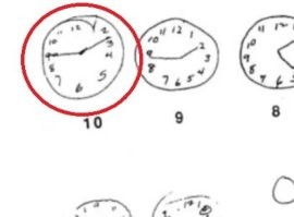 Правильно так, как я нарисовала и выложила в предыдущем комментарии, а не так, как показано в статье. 

Но, вижу, некоторые слишком туги на ум, чтобы понять, что разговор (=мой предыдущий комментарий) идёт о картинке в статье, а выложенная мною картинка (в предыдущем комментарии - уточняю для особо одарённых) - показать, как должно быть.