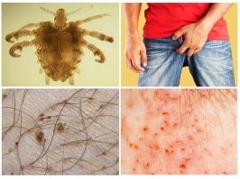 Вовсе не для красоты. Зачем католические монахи выбривают себе макушку