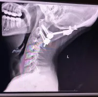 На это смотреть ещё больнее, чем на вилку в ноге.