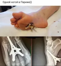 Как?! Он прыгнул что ли на неё?