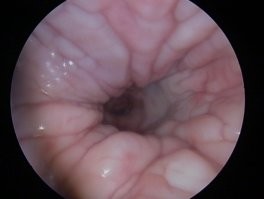 влагалище изнутри