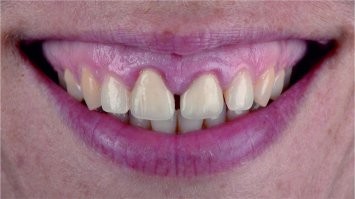 Когда у девушки в улыбке видны полностью дёсны - это как-то... фу.