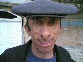 вот носуха...