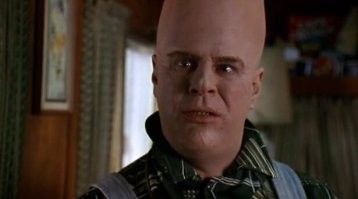 Тепловой отек превратил мужчину в инопланетянина