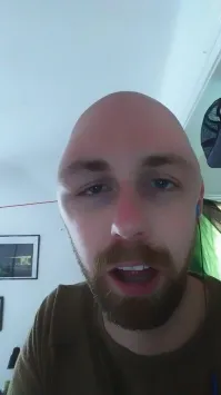 Конгресс фриков? :) Да случай интересный, но не такой редкий. Немного покопался в гугле. Всех объединяет одно - они лысые или короткостриженные.