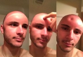 Конгресс фриков? :) Да случай интересный, но не такой редкий. Немного покопался в гугле. Всех объединяет одно - они лысые или короткостриженные.
