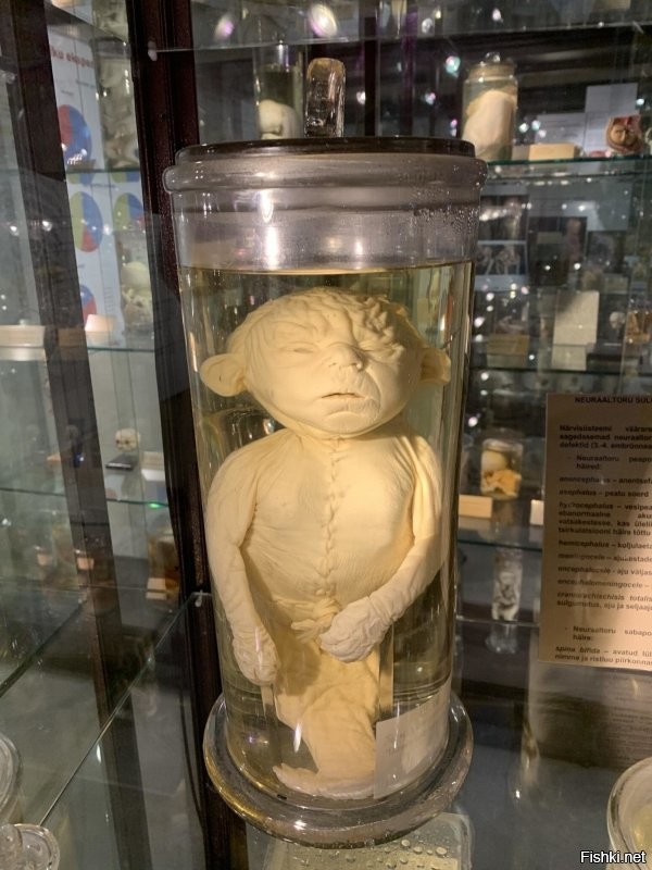 Нет лучше вот такое рожать ? . Бывает когда находят сразу патологию и лучше сделать аборт , летом ходил в музей там такого насмотрелся .
