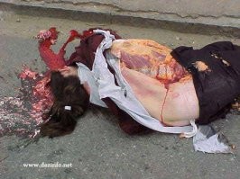 Можете поставить мне хоть сто минусов, но если эта картинка остановит хотя бы одну дуру, дело того стоит.