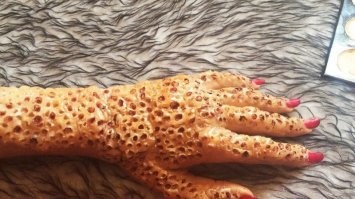 Вызывает приступ трипофобии.