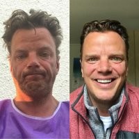 Бросил пить. "До" и "после"