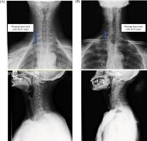 >> Со временем шея становится неестественной длины.
Не становится.. опускается верхний плечевой отдел.