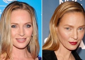 Ума Турман тоже неудачно починила.