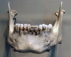 В который раз эта муйня с 4-х тысячной медной проволокой уже выскакивает. Да, кстати, дырки сверлили аккумуляторной бормашиной!