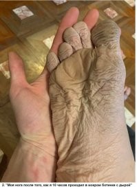 Эк, как её-то вывернуло, ...или связи с туловищем уже не наблюдается?