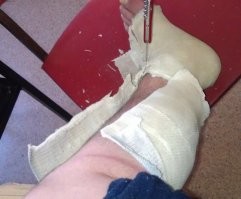 Ну я-то в курсе. 
У самого был "негипсовый гипс". 
Только без "вентиляции". :) 
Но воды он, тоже не боялся.