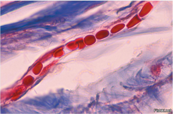 Кровь из пальца в переводе на чуть менее простонародный – кровь из капилляра.
Толщина одного капилляра – 5 – 10 мкм, а клеток крови эритроцитов – 5 – 7 мкм. В идеальном сосуде эритроциты ползут аккуратно цепочкой друг за другом…
